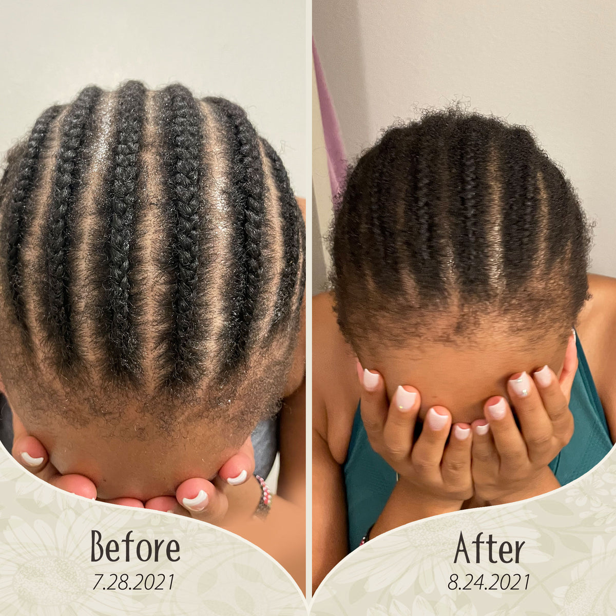 Inch x Inch Hair Growth Rejuvenation Serum – Aurous Luminous