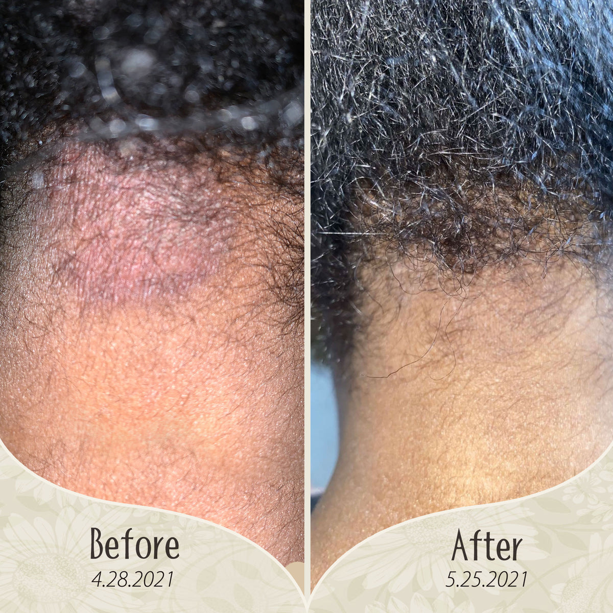 Inch x Inch Hair Growth Rejuvenation Serum – Aurous Luminous