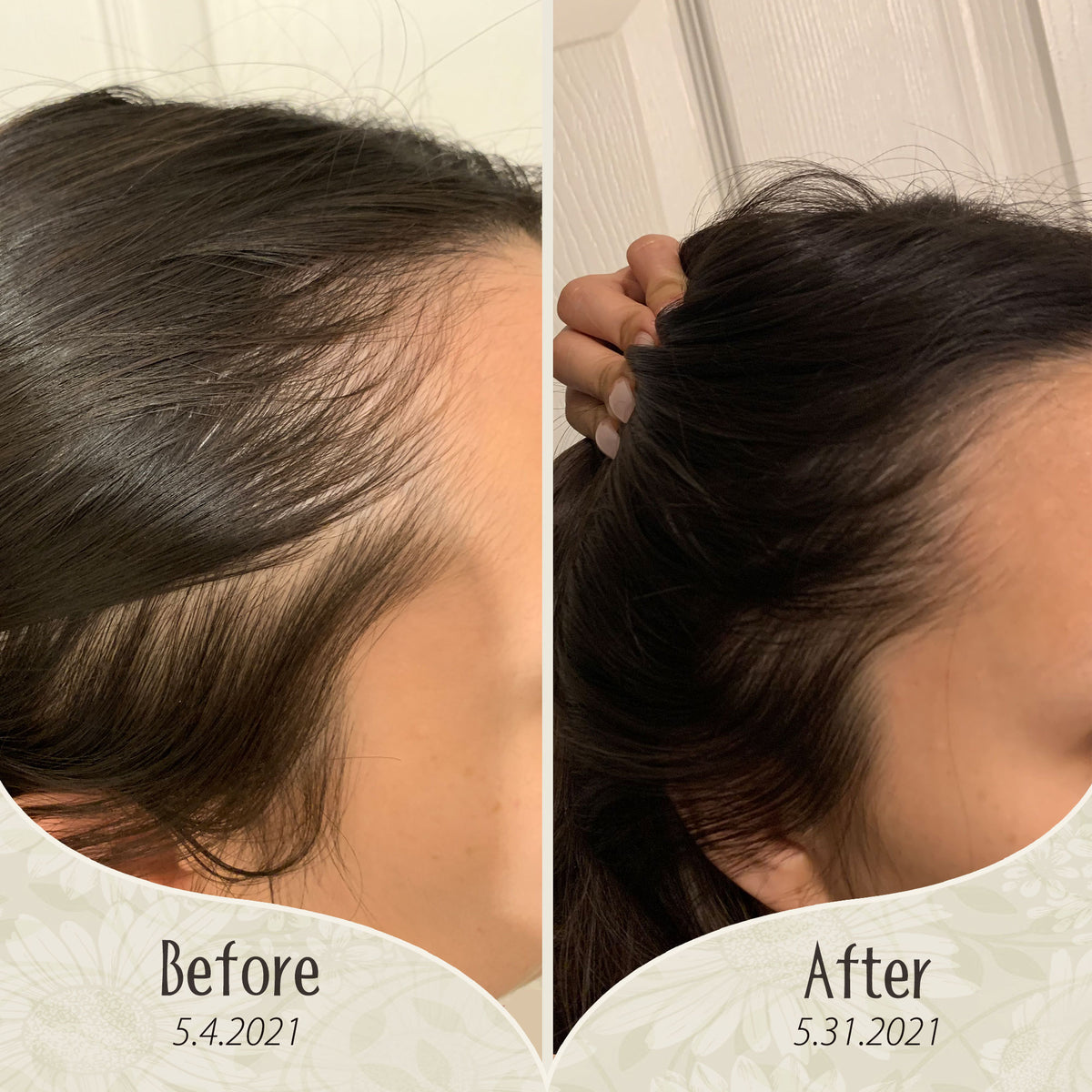 Inch x Inch Hair Growth Rejuvenation Serum – Aurous Luminous